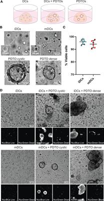 Dendritic cell phenotype and function in a 3D co-culture model of patient-derived metastatic colorectal cancer organoids